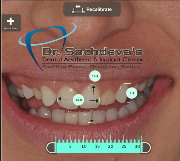 smile dentistry